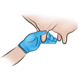 Zitzenbasis verschließen