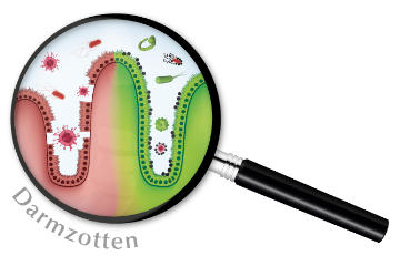 Die Folgen von Endotoxinen im Stoffwechsel